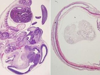 mouse fetuses